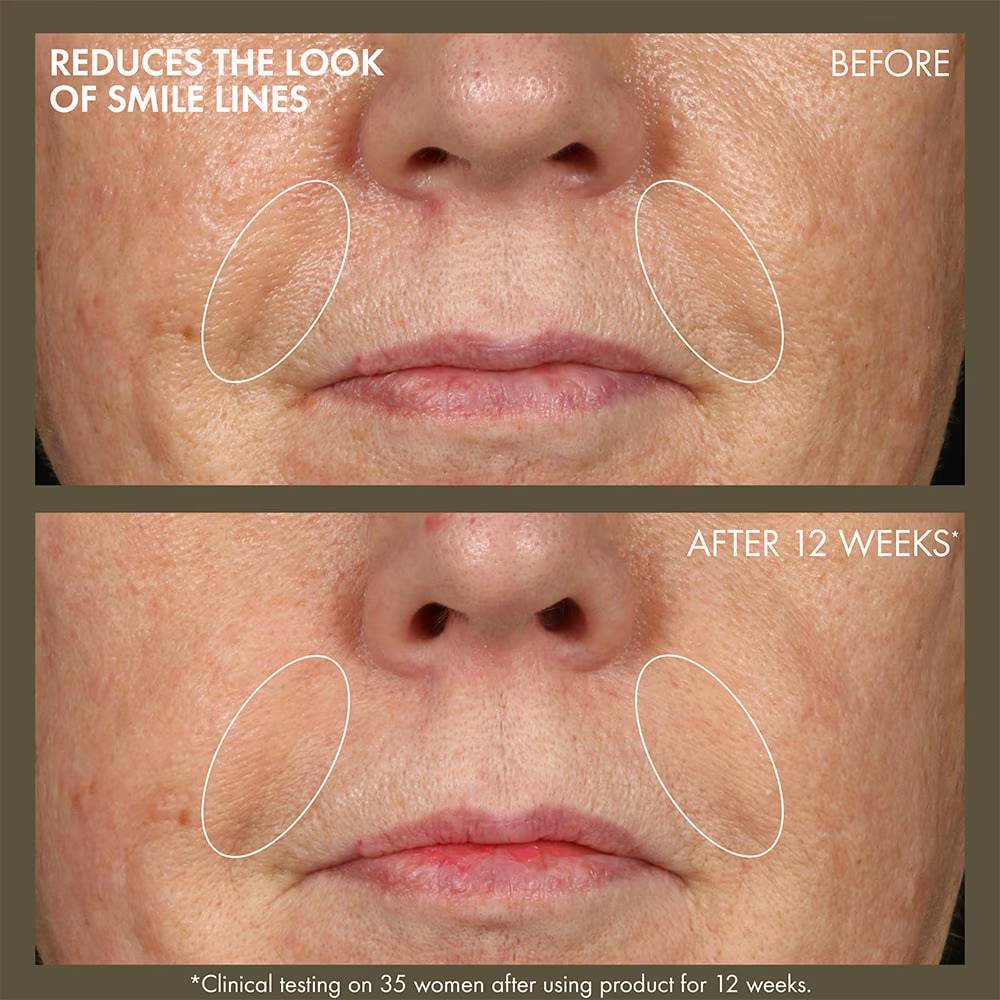 Origins Plantscription™ Active Wrinkle Correction Serum
