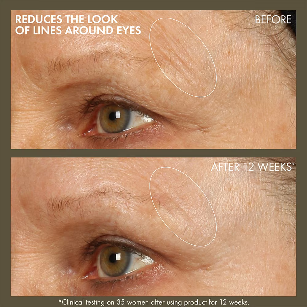 Origins Plantscription™ Active Wrinkle Correction Serum