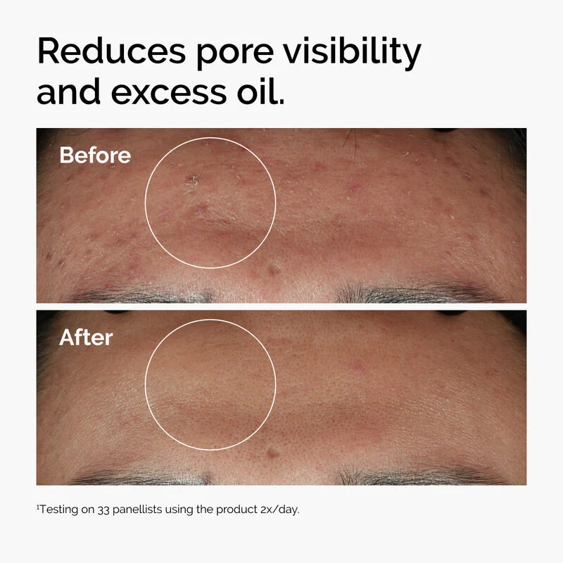 Niacinamide Serum  30ml