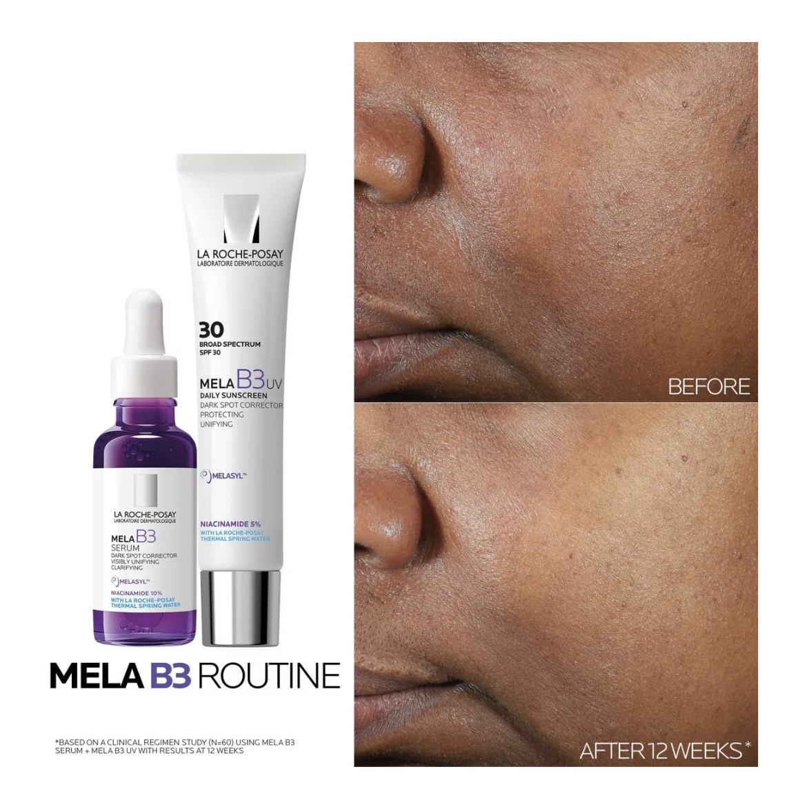 Mela B3 Dark Spot Serum 30ml
