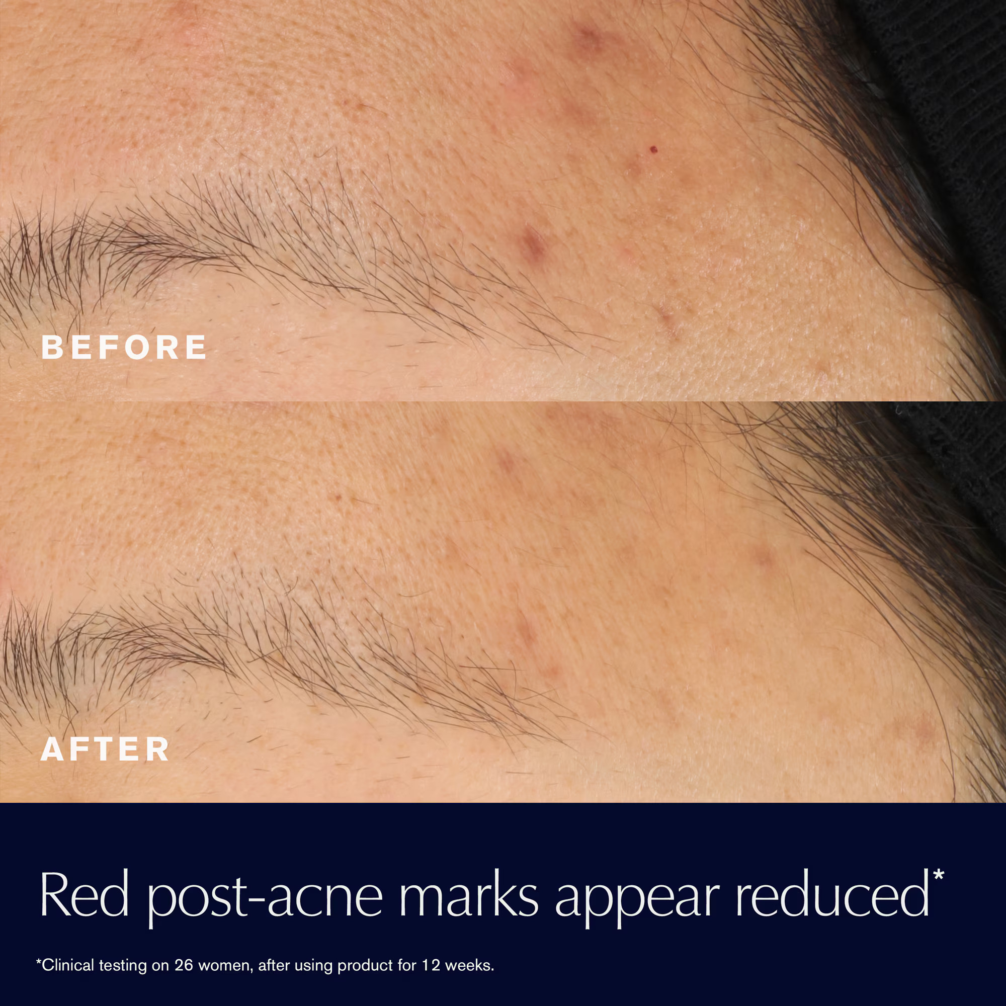 ANR Rescue Solution Serum