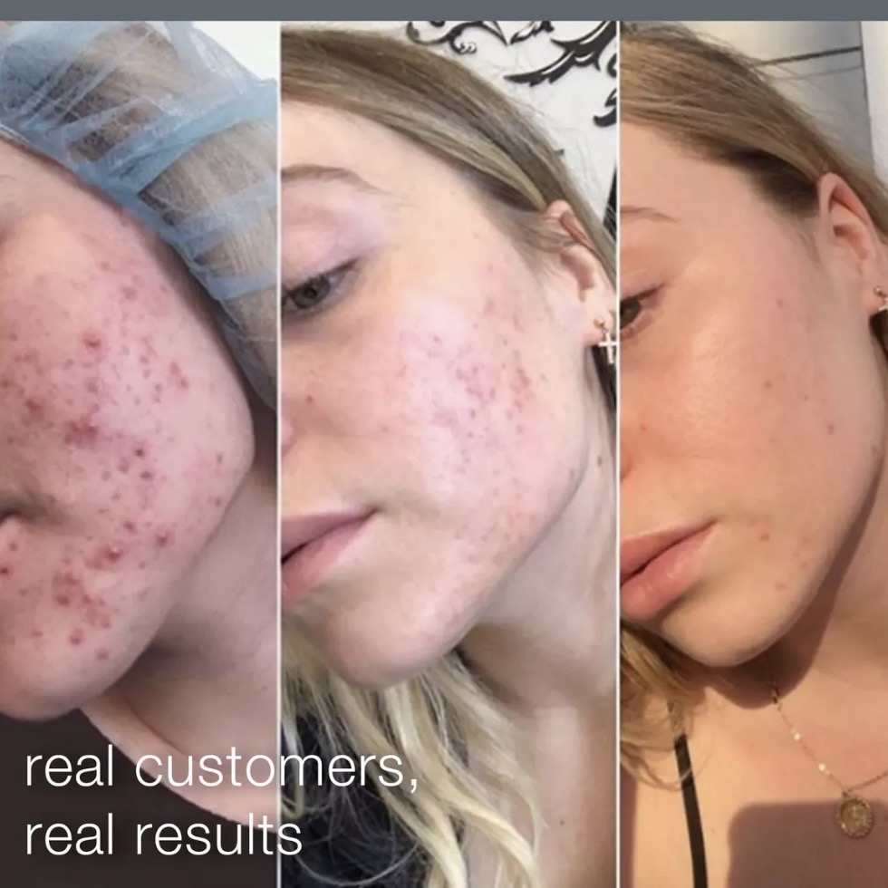 Daily Microfoliant Exfoliator 4g