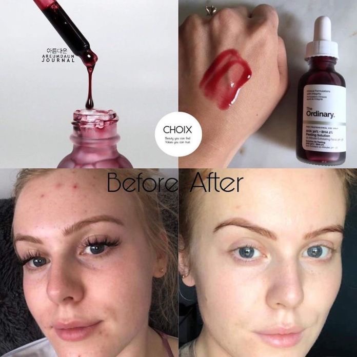 The Ordinary AHA 30% + BHA 2% High-Strength Peeling Solution for Brightening 30ml