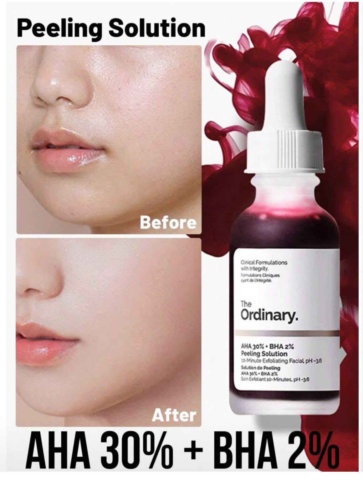 The Ordinary AHA 30% + BHA 2% High-Strength Peeling Solution for Brightening 30ml