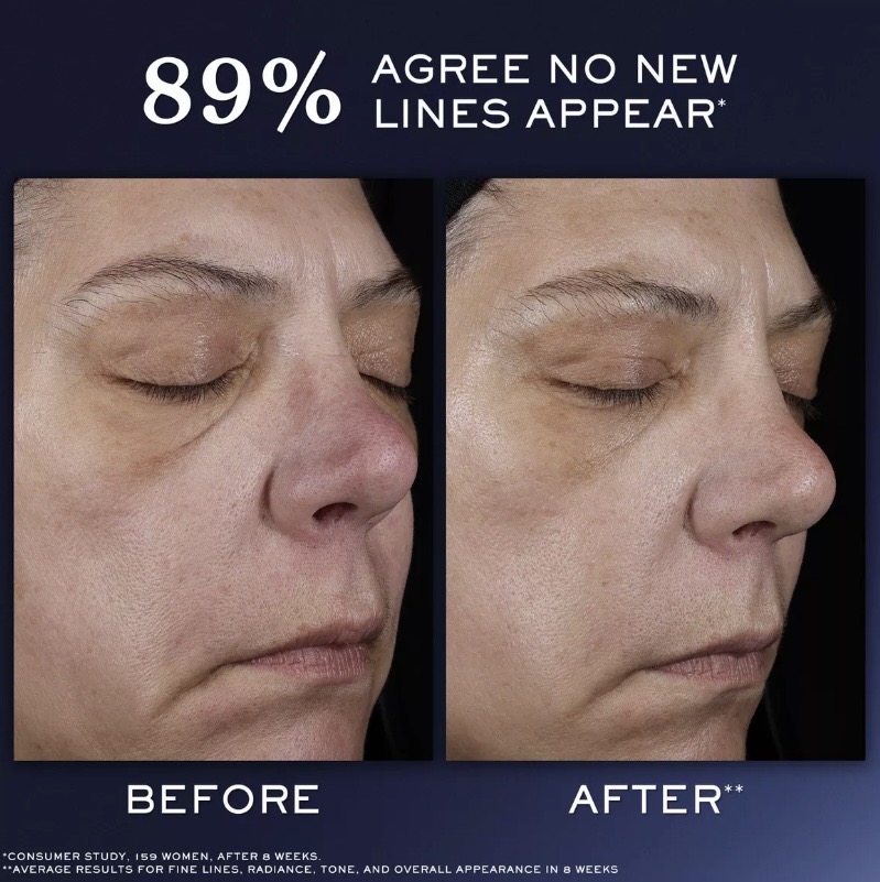 Génifique Ultimate Recovery Serum 30ml
